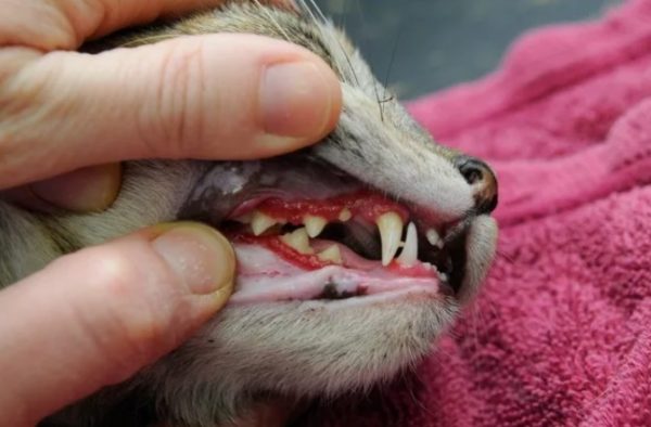 Постепенно воспаление распространяется в зону зубного корня и затрагивает костную лунку — так начинается пародонтит